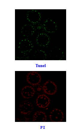 TUNEL检测实验报告（三）